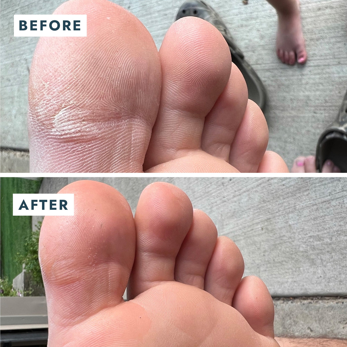 Voesh - Heel Repair Duo (Heel Repair Balm + Heel Socks) - VFC001MNT